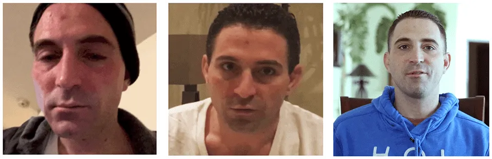 Johns-Drug-Reabilitation-with-the-Pouyan-Method-Treatment.png (2)